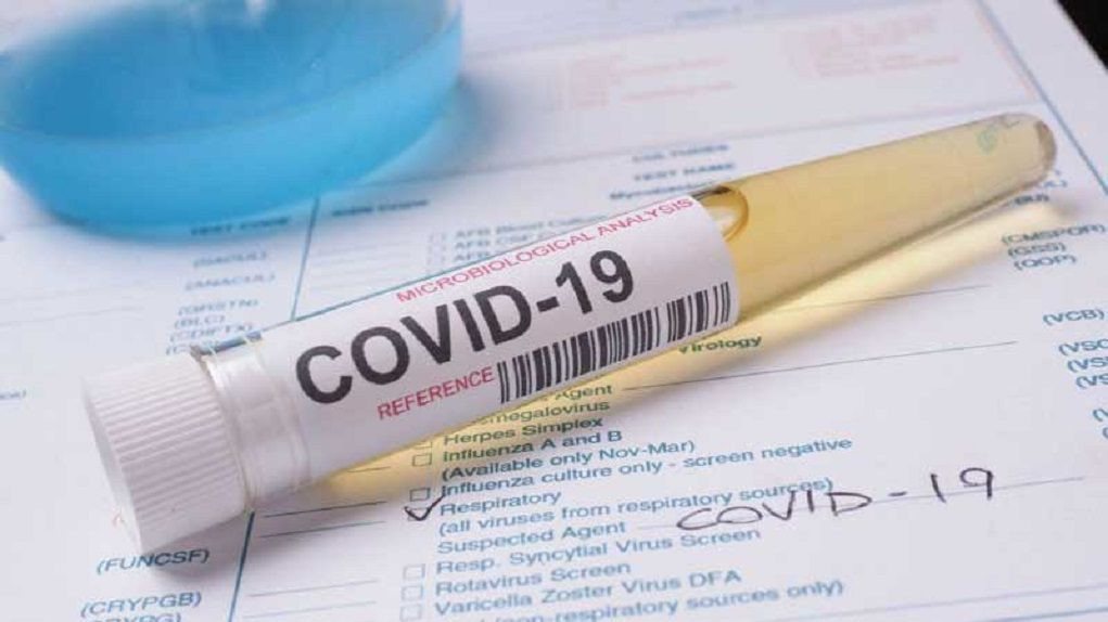 Τρίτο κρούσμα COVID-19 στην Κέρκυρα σύμφωνα με τον ΕΟΔΥ