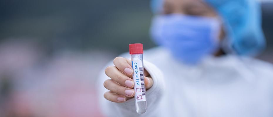 262 νέα κρούσματα στην Ελλάδα, μόνο ένα στην Κέρκυρα